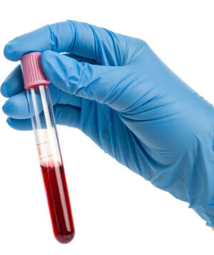 Arthregen™ Metabolic Resilience Score (AMRS)