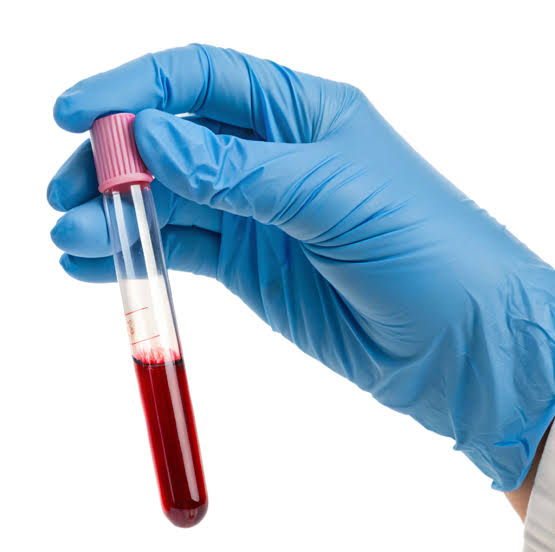 Arthregen™ Metabolic Resilience Score (AMRS)