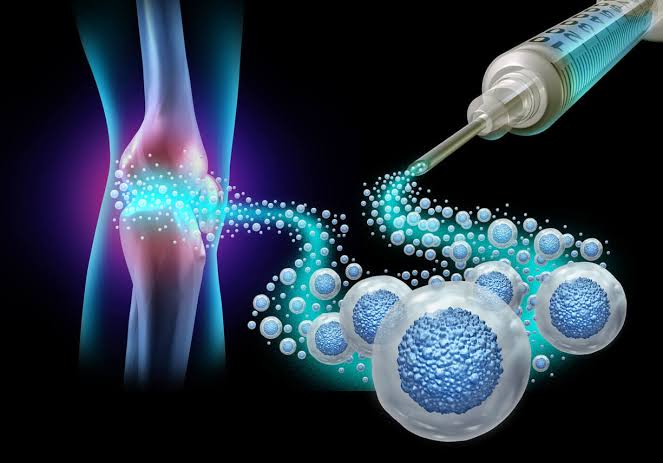 Future Ortho UC MSC Stem Cell Joint Injections