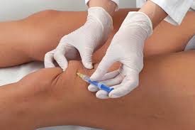 MD Guna Collagen Joint and Soft Tissue Injections